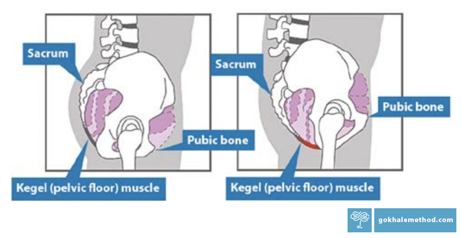Diagram of the pelvis anteverted, and tucked, and pelvic floor muscle.